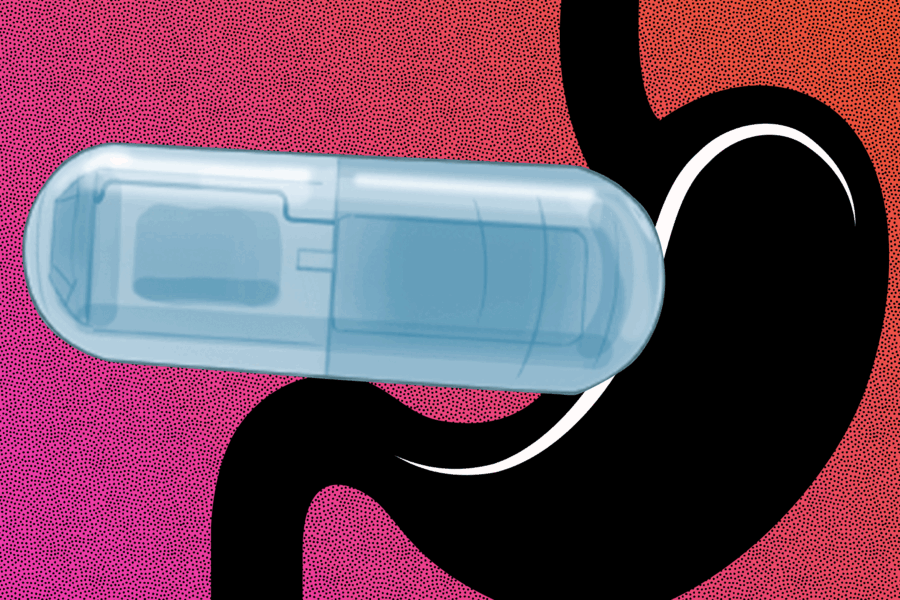 This New Vibrating Pill Promises a New Approach to Weight Loss 1 Vibrating Pill